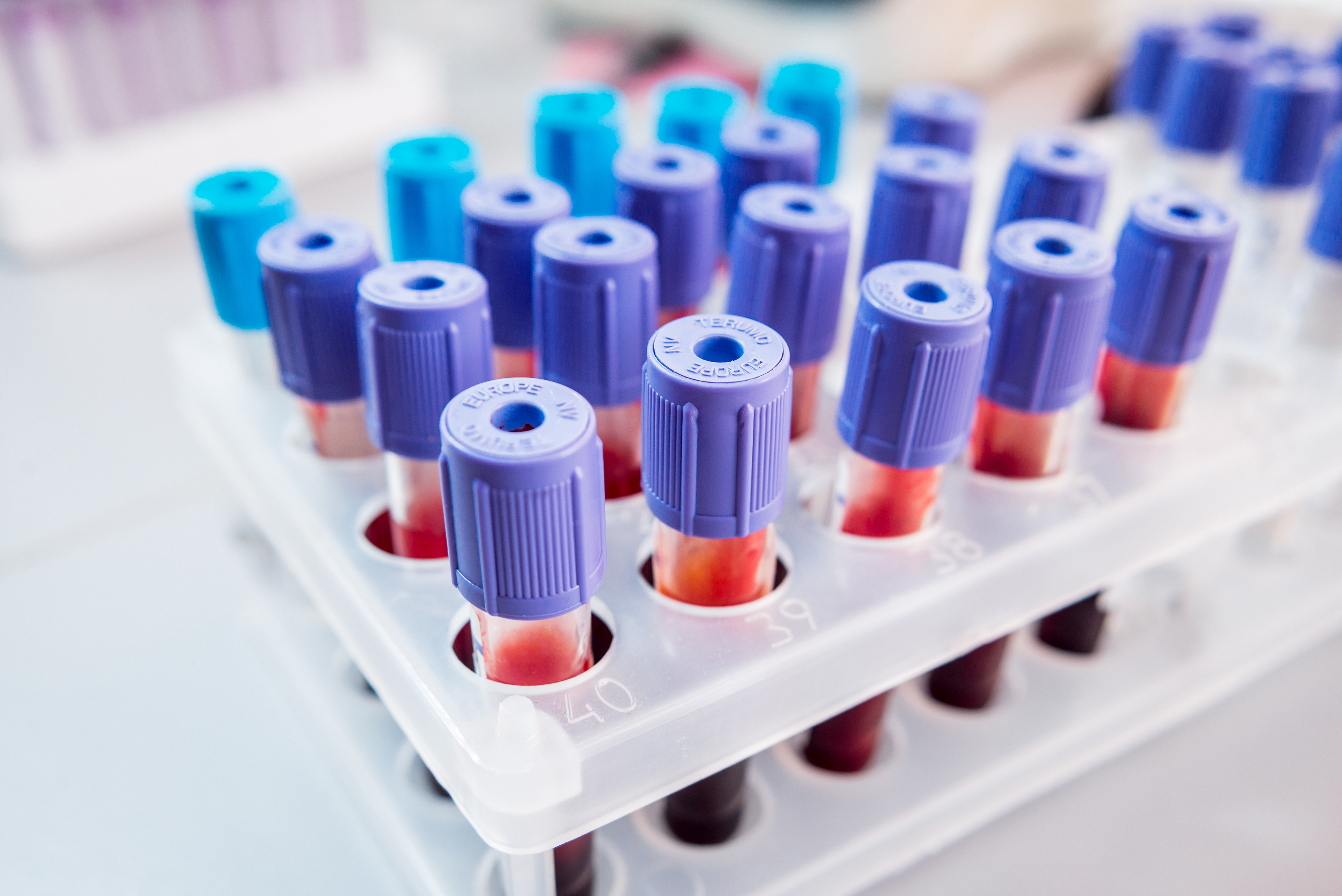 Can a Blood Test Find Cancer Early?